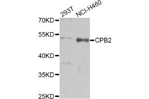 Western blot analysis of extracts of various cell lines, using CPB2 Antibody (ABIN1876835) at 1:1000 dilution.