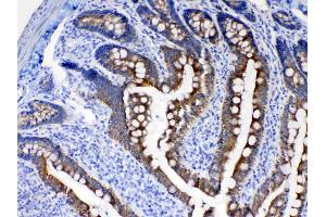 IHC analysis of Cytokeratin 8 using anti- Cytokeratin 8 antibody . (KRT8 Antikörper  (AA 107-325))
