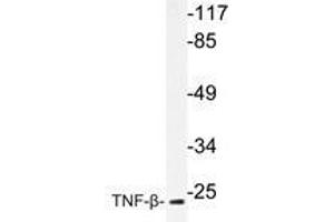 Western blot analysis of TNF-β antibody in extracts from COS-7cells. (LTA Antikörper)
