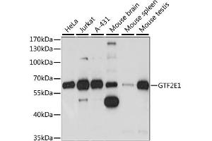 Western blot analysis of extracts of various cell lines, using GTF2E1 antibody (ABIN6292967) at 1:1000 dilution. (GTF2E1 Antikörper)