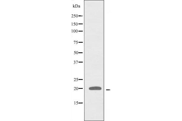 RPL28 anticorps