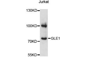 Western blot analysis of extracts of Jurkat cells, using GLE1 antibody (ABIN6293109) at 1:3000 dilution. (GLE1 Antikörper)