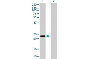 Western Blot analysis of PTTG1IP expression in transfected 293T cell line by PTTG1IP monoclonal antibody (M04), clone 4C11. (PTTG1IP Antikörper  (AA 1-180))