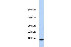 WB Suggested Anti-PCBD1 Antibody Titration:  0.
