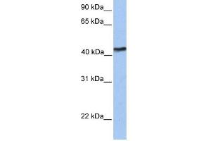 TMEM149 antibody used at 1 ug/ml to detect target protein. (IGF-like family receptor 1 (IGFLR1) (N-Term) Antikörper)