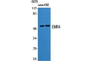 Western Blot (WB) analysis of specific cells using EMR4 Polyclonal Antibody.