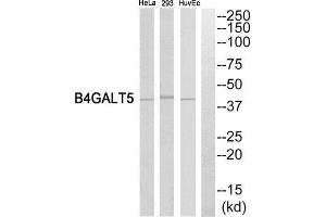 Western Blotting (WB) image for anti-UDP-Gal:betaGlcNAc beta 1,4- Galactosyltransferase, Polypeptide 5 (B4GALT5) (C-Term) antibody (ABIN1850912) (B4GALT5 Antikörper  (C-Term))