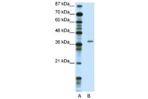 WB Suggested Anti-ZNF444  Antibody Titration: 2.