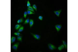 Immunofluorescence staining of Hela cells with ABIN7153359 at 1:166, counter-stained with DAPI. (Gpr98 Antikörper  (AA 6155-6306))