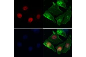 HELLS Antibody staining Hela cells by IF/ICC. (HELLS Antikörper  (Internal Region))