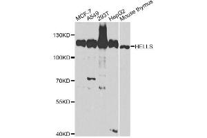 Western blot analysis of extracts of various cell lines, using HELLS antibody (ABIN2563021) at 1:1000 dilution. (HELLS Antikörper)