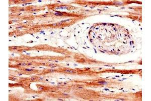 IHC image of ABIN7168677 diluted at 1:600 and staining in paraffin-embedded human heart tissue performed on a Leica BondTM system. (SFRP1 Antikörper  (AA 170-240))