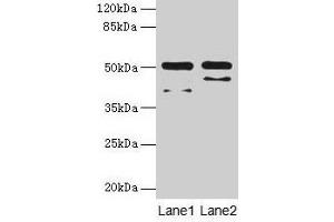 CRHR1 antibody  (AA 24-121)