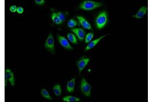 Immunofluorescence staining of A549 cells with ABIN7167433 at 1:230, counter-stained with DAPI. (RAMP2 Antikörper  (AA 43-145))