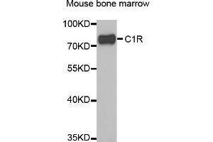 Western blot analysis of extracts of mouse bone marrow, using C1R antibody (ABIN5973769) at 1/1000 dilution. (C1R Antikörper)