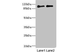 Western blot All lanes: ICAM5 antibody at 4. (ICAM5 Antikörper  (AA 32-180))