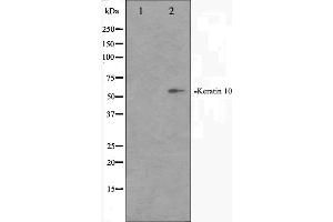 Western blot analysis on HeLa cell lysate using Keratin 10 Antibody. (Keratin 10 Antikörper  (Internal Region))