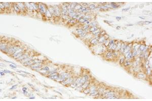 Immunohistochemistry (IHC) image for anti-Tripartite Motif Containing 3 (TRIM3) (AA 1-50) antibody (ABIN7454392)