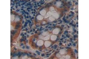 Used in DAB staining on fromalin fixed paraffin- embedded Kidney tissue (ACTN3 Antikörper  (AA 162-416))