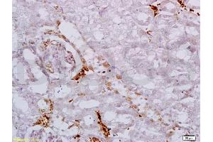 Formalin-fixed and paraffin embedded mouse kidney labeled with Anti AAK1 Polyclonal Antibody, Unconjugated (ABIN687517) at 1:200 followed by conjugation to the secondary antibody and DAB staining (AAK1 Antikörper  (AA 301-400))
