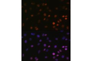 Immunofluorescence analysis of C6 cells using MonoMethyl-Histone H2B-K5 antibody (ABIN7267735) at dilution of 1:100.