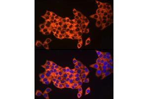 Immunofluorescence analysis of HeLa cells using UB Rabbit mAb (ABIN7271128) at dilution of 1:50 (40x lens). (UBA52 Antikörper)