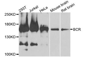 Western blot analysis of extracts of various cell lines, using BCR antibody. (BCR Antikörper)