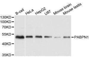 Western blot analysis of extracts of various cell lines, using PABPN1 antibody. (PABPN1 Antikörper  (AA 1-100))