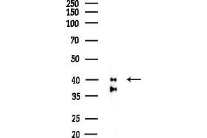anti-Casein Kinase 2, alpha Prime Polypeptide (CSNK2A2) (N-Term) antibody