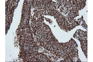 Image no. 7 for anti-NADH Dehydrogenase (Ubiquinone) 1 beta Subcomplex, 10, 22kDa (NDUFB10) antibody (ABIN1499669)