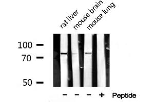 Western blot analysis of extracts of various tissue ,using SENP1 antibody. (SENP1 Antikörper  (N-Term))