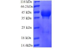 Ribosomal Protein L35 (RPL35) (AA 2-123), (full length) protein (GST tag)