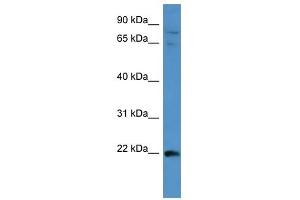 MAP3K15 antibody used at 1 ug/ml to detect target protein. (MAP3K15 Antikörper  (Middle Region))