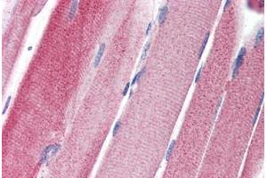 Human Skeletal Muscle (formalin-fixed, paraffin-embedded) stained with GPAM antibody ABIN351457 at 5 ug/ml followed by biotinylated goat anti-rabbit IgG secondary antibody ABIN481713, alkaline phosphatase-streptavidin and chromogen. (GPAM Antikörper  (C-Term))