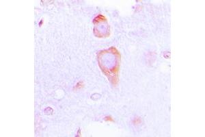 Immunohistochemical analysis of GUCY1B3 staining in human brain formalin fixed paraffin embedded tissue section. (GUCY1B3 Antikörper  (N-Term))