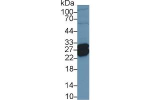 Detection of TNNI1 in Porcine Heart lysate using Polyclonal Antibody to Troponin I Type 1, Slow Skeletal (TNNI1) (TNNI1 Antikörper  (AA 1-187))