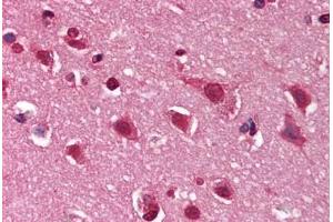 Human Brain, Cortex (formalin-fixed, paraffin-embedded) stained with DNM1 antibody ABIN291352 at 10 ug/ml followed by biotinylated goat anti-rabbit IgG secondary antibody ABIN481713, alkaline phosphatase-streptavidin and chromogen. (Dynamin 1 Antikörper  (C-Term))