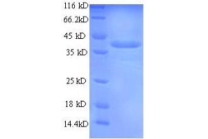 SDS-PAGE (SDS) image for Chymase 1, Mast Cell (CMA1) (AA 22-249) protein (His-SUMO Tag) (ABIN5709295)