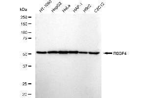 Western blotting analysis using RBBP4 antibody (ABIN7800185). (Rekombinanter Retinoblastoma Binding Protein 4 Antikörper)
