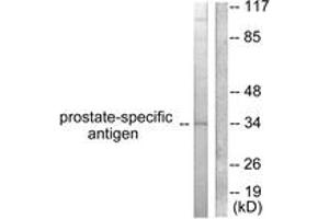Western blot analysis of extracts from mouse heart cells, using Prostate-specific Antigen Antibody. (Prostate Specific Antigen Antikörper  (AA 81-130))