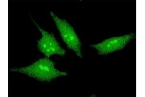 Immunofluorescence of monoclonal antibody to SCAND2 on HeLa cell. (SCAND2 Antikörper  (AA 1-62))