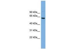Image no. 1 for anti-Core-binding Factor, Runt Domain, alpha Subunit 2, Translocated To, 2 (CBFA2T2) (AA 361-410) antibody (ABIN6744633)