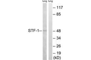 Image no. 1 for anti-Nuclear Receptor Subfamily 5, Group A, Member 1 (NR5A1) (AA 169-218) antibody (ABIN2889160) (NR5A1 Antikörper  (AA 169-218))