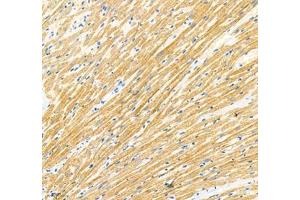 Immunohistochemistry of paraffin embedded rat heart using Sarcomeric α Actinin (ABIN7075510) at dilution of 1: 1000 (200x lens) (Sarcomeric alpha Actinin Antikörper)