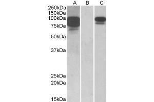 HEK293 lysate (10ug protein in RIPA buffer) overexpressing Human PCSK9 with C-terminal MYC tag probed with ABIN570954 (1ug/ml) in Lane A and probed with anti-MYC Tag (1/1000) in lane C. (PCSK9 Antikörper  (AA 214-228))