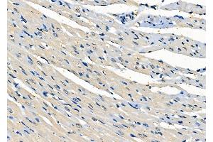 ABIN6261047 and ABIN6278023 at 1/100 staining Rat heart tissue by IHC-P.