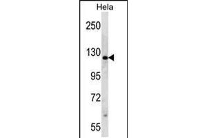 Western blot analysis in Hela cell line lysates (35ug/lane). (PARP1 Antikörper  (N-Term))