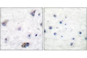 Immunohistochemistry analysis of paraffin-embedded human brain, using GABA-RB (Phospho-Ser434) Antibody. (GABA-RB (AA 401-450), (pSer434) Antikörper)