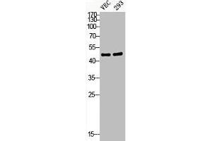 Western Blot analysis of VEC 293 cells using Phospho-HDAC8 (S39) Polyclonal Antibody (HDAC8 Antikörper  (pSer39))