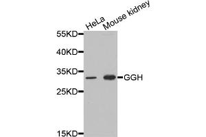 Western blot analysis of extracts of various cell lines, using GGH antibody (ABIN5973177) at 1/1000 dilution. (GGH Antikörper)